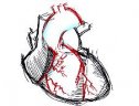 El infarto del miocardio | Recurso educativo 51902